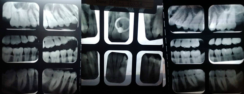 human_lamprey onlyfans leaked picture 1